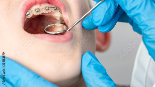 Fototapeta Naklejka Na Ścianę i Meble -  Dentist using an instrument to visualize the teeth of a child patient