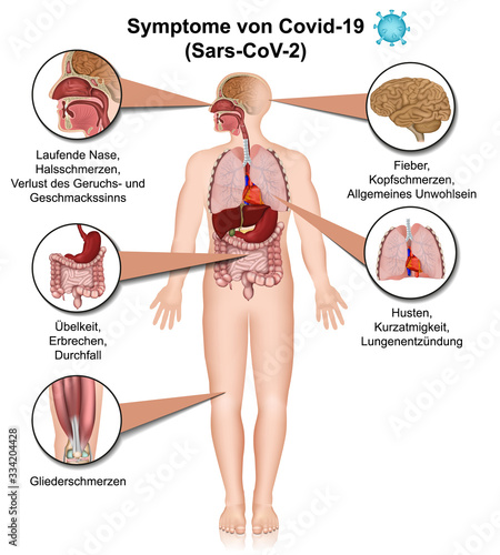 symptoms of covid-19 infographic, coronavirus info isolated on white background german
