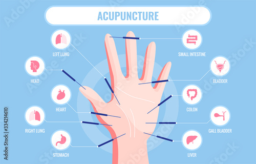 Vector illustration of traditional Chinese acupuncture medicine