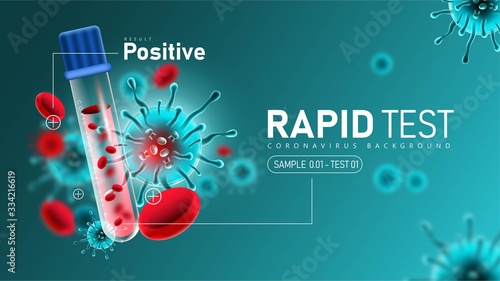 Coronavirus 2019- ncov Rapid Test with Positive Result