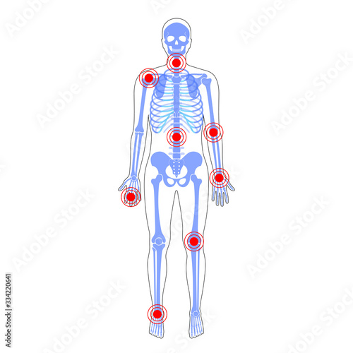 Joint pain on skeleton in human body