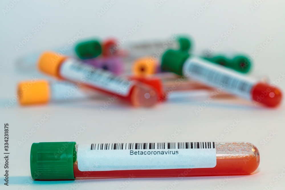 Blood test tubes for coronavirus. Blood test tubes for coronavirus.