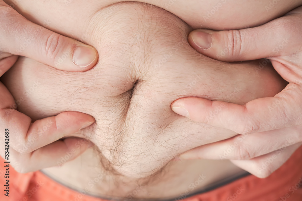 Hands of a man holding excess fat on stomach, close-up. Overweight person. Healthy lifestyle concept. Hands of a man holding excess fat on stomach, close-up. Overweight person. Healthy lifestyle concept.