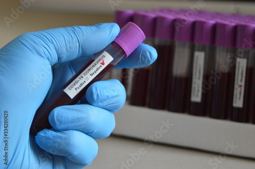 Negative blood test result for the Coronavirus Covid-19 photo