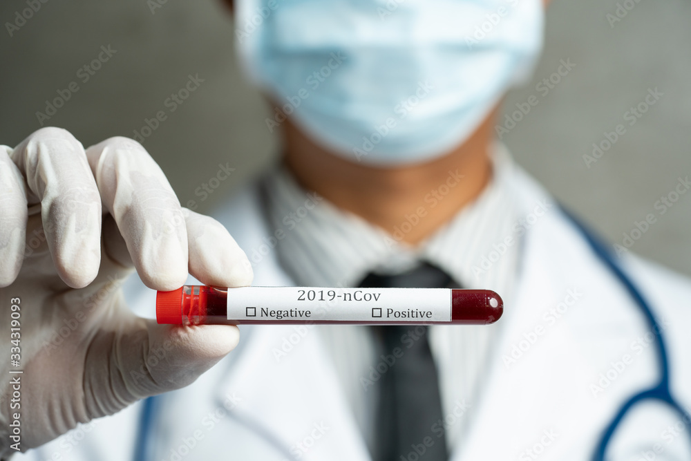 Corona virus COVID 19 test novel corona virus Corona virus COVID 19 test novel corona virus