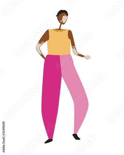 A Vetiligo and a man or woman with black skin isolated on a white background, a Scandinavian African American and Dermatology vector stock illustration