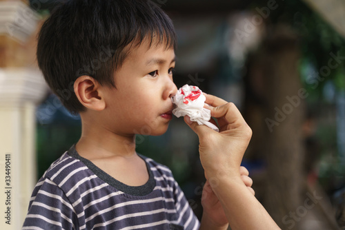 Asian boy with nose bleeding problem photo