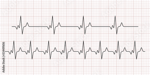 Cardiogram. Heart beat. Heartbeat line. Electrocardiogram. Vector