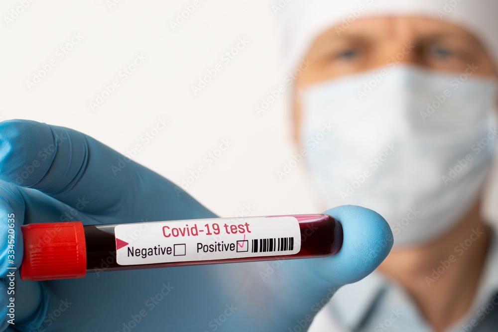 Positive Covid-19 test in hands of an experienced doctor in medical mask and gloves Positive Covid-19 test in hands of an experienced doctor in medical mask and gloves