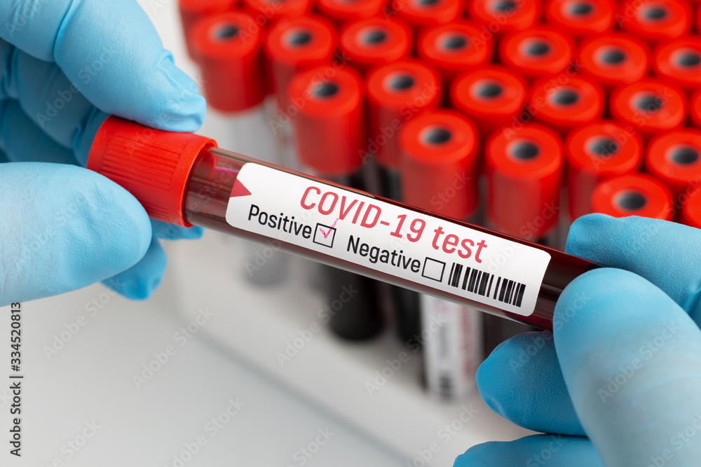 Obraz premium Testing blood on coronavirus. Medical worker holds coronavirus blood test that shows that person is infected and needs special treatment and isolation