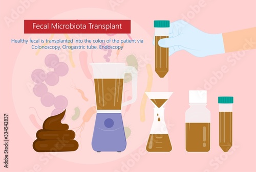 Fecal microbiota transplant (FMT) stool transferring bacteria microbes 