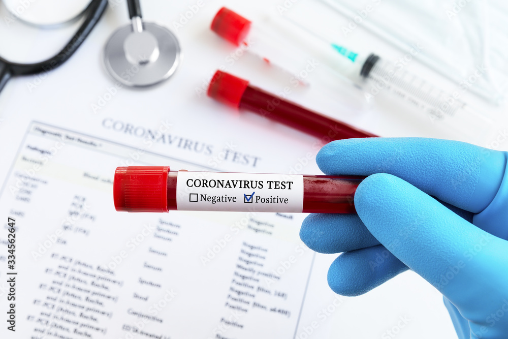 Coronavirus blood test concept.