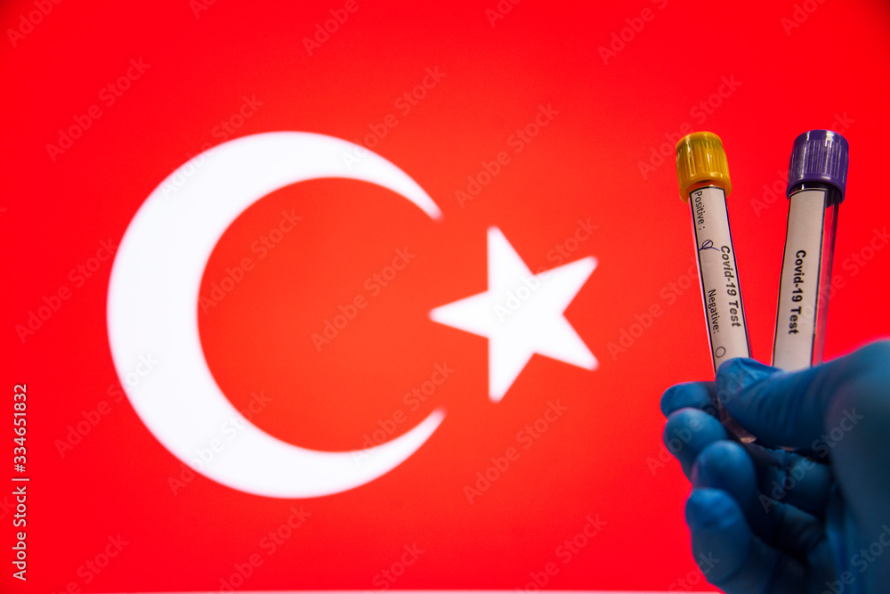 Coronavirus or Covid-19 in Turkey, sample blood tubes in hand Turkish flag on background, Blood sample with COVID-19 Coronavirus Chinese infection Turkey
