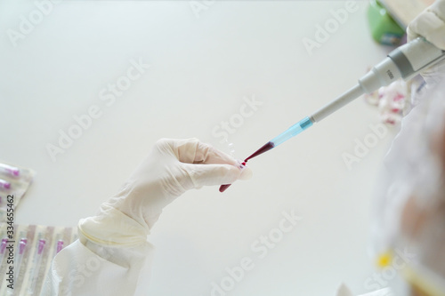 Coronavirus Covid-19 Doctor in the laboratory with a biological tube sampling of Covid-19 infectious disea/lab technician holding blood tube sample for study. photo