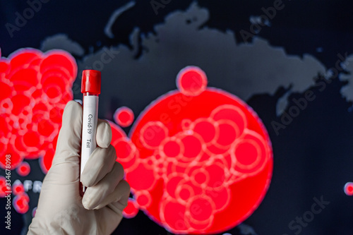 A medic holds a test tube with blood for analysis of 2019 nKoV. Coronavirus blood test concept. Test for COVID-19 in the hands of a doctor photo