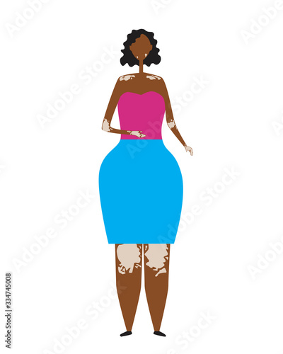 A Vetiligo and an adult African American woman isolated on a white background, a Scandinavian vector stock illustration as a concept of a body positive on black leather