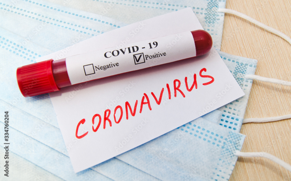 Obraz premium Coronavirus blood test concept. Test tube with coronavirus positive blood over laboratory desk