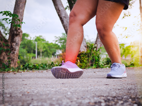 Fat women, ankle sprain while running or walking