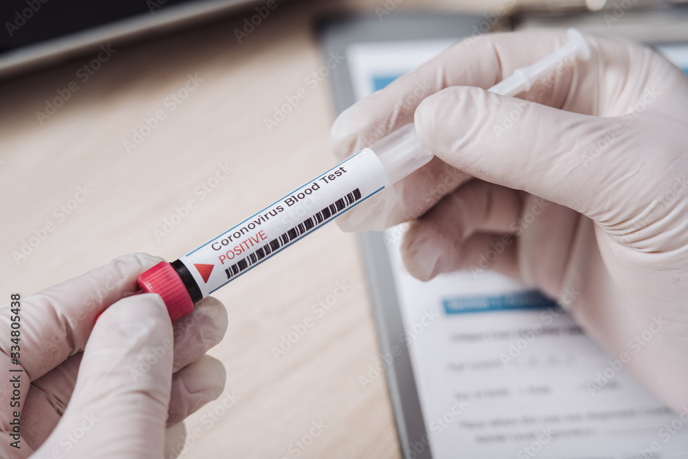 Naklejka premium Doctor with a modern tube of biological sample contaminated by Coronavirus. Technician making medical exam in the laboratory. Specialist fills the medical form after taking blood from the patient. 