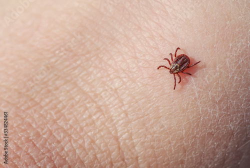 dangerous insect mite crawls on human skin causing various infectious disease
