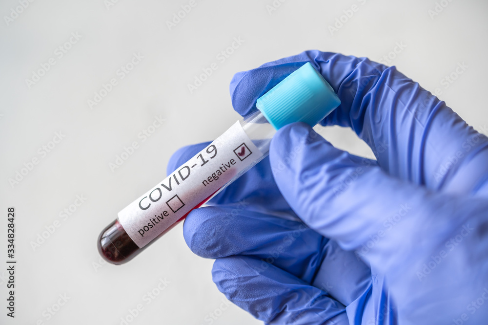 Fototapeta premium Coronavirus testing