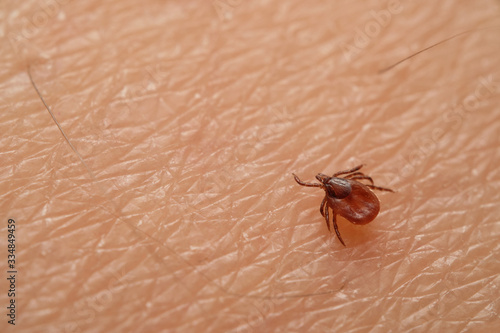 Tick (Ixodes ricinus) on skin. Dangerous mite, can cause Lyme disease (borreliosis), tick-borne encephalitis and ehrlichiosis. Europe, Czech Republic © Mi St