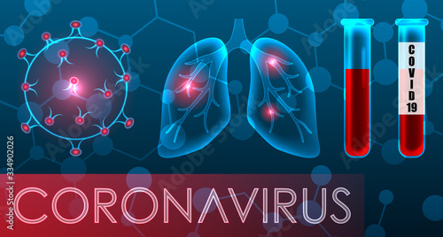 Coronavirus 2019-nCoV. Infected Lungs, Symptoms. SARS Pandemic. Vaccine