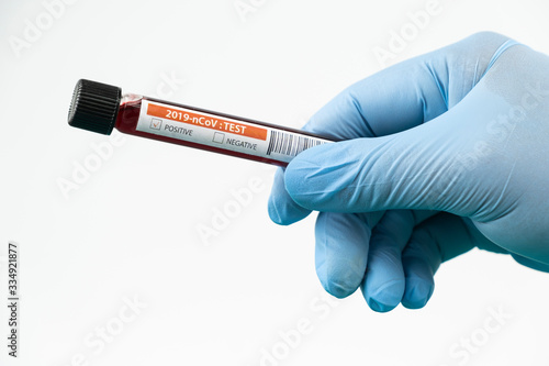 Test tube with blood sample in lab for COVID-19 test in hand of doctor wear blue glove, laboratory sample of blood testing for diagnosis new Corona virus infection, the pandemic infectious concept