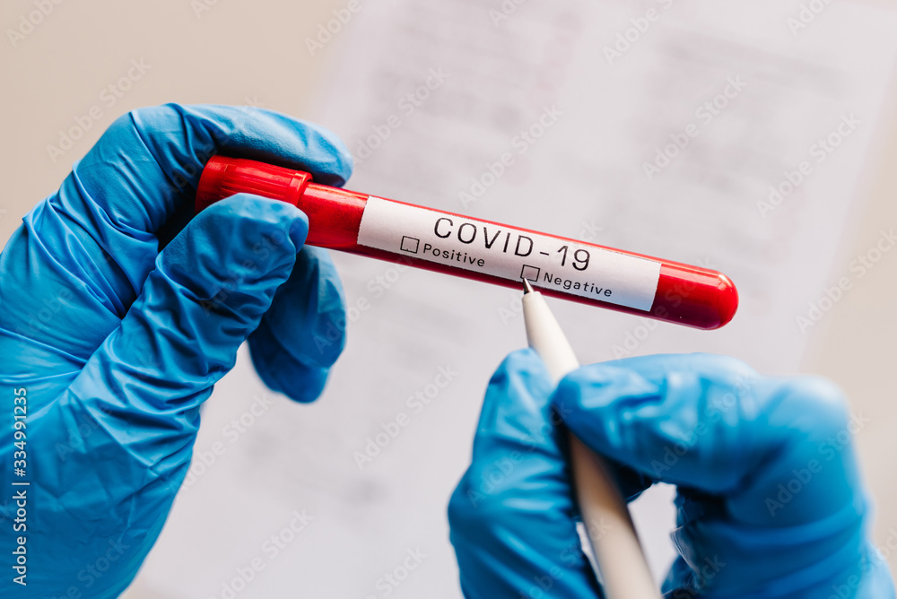 Covid-19 text. A hands of doctor, nurse, scientist writes with a pen and confirms the negative result, hold a test tube with biological sample. Coronavirus. Blood is dont infected. New cases of cure. Covid-19 text. A hands of doctor, nurse, scientist writes with a pen and confirms the negative result, hold a test tube with biological sample. Coronavirus. Blood is dont infected. New cases of cure.