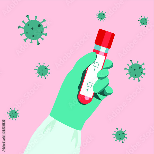 Coronavirus rapid blood test in a laboratory