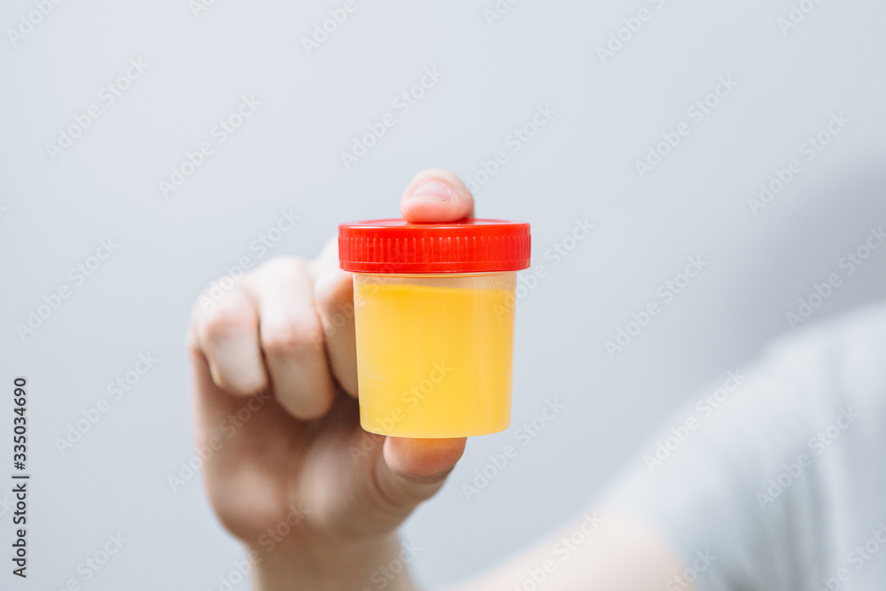 Bank with the analysis of urine, pills and diseases. Laboratory Bank with the analysis of urine, pills and diseases. Laboratory