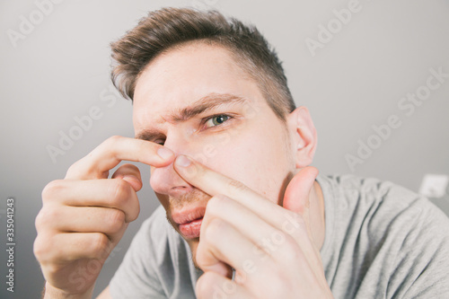 Fototapeta Naklejka Na Ścianę i Meble -  Young guy pushes acne on his face