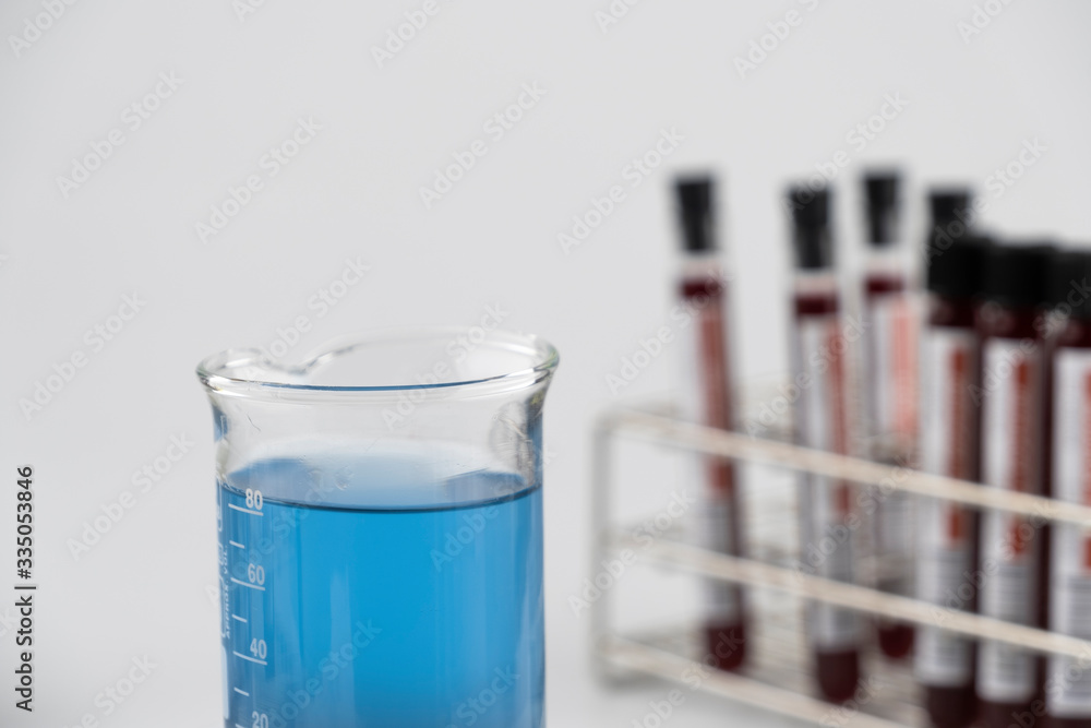 Methylene blue test liquid with blood sample for test, laboratory sample of blood testing for diagnosis virus infection, the pandemic infectious concept Methylene blue test liquid with blood sample for test, laboratory sample of blood testing for diagnosis virus infection, the pandemic infectious concept