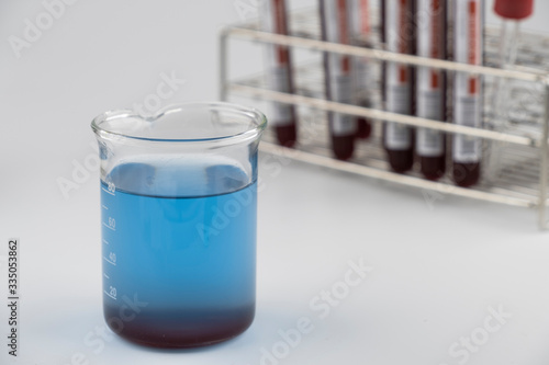 Methylene blue test liquid with blood sample for test, laboratory sample of blood testing for diagnosis virus infection, the pandemic infectious concept