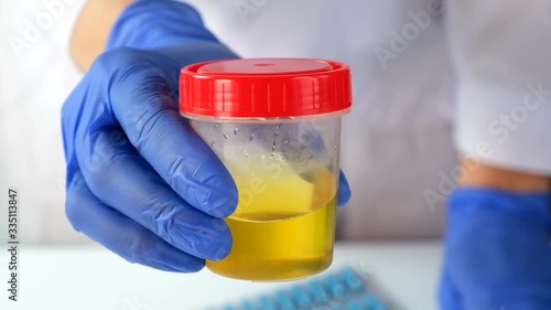 Doctor or laboratory technician showing container with urine sample for analysis and research in medical laboratory, medical urine test and health scanning.