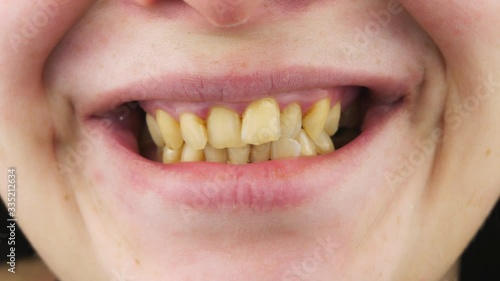 Curves yellow teeth close up.
