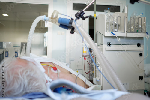 Patient with coronavirus pneumonia in critical state. Intubated senior under ventilator lying in coma in intensive care department. photo