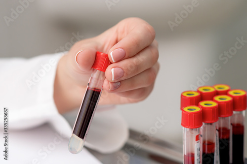 Doctor takes blood sample tube from tray on the table.