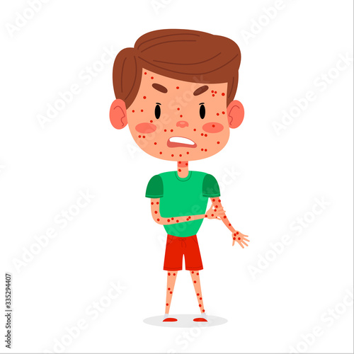 Kid boy has chickenpox or measles disease. Red rash on children body vector illustration