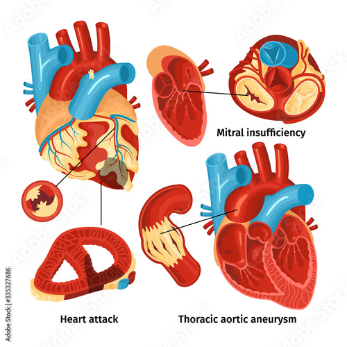 Heart Anatomy Set