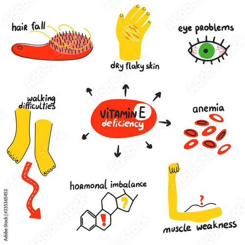 Hand drawn vitamin E tocopherol deficiency: hair loss, eyeproblem, anemia, muscle weakness, hormonal imbalance. Vector illustration is for pharmalogical or medical poster, brochure.