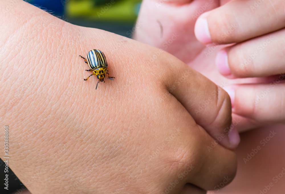 Colorado potatoe beetle on child arm.