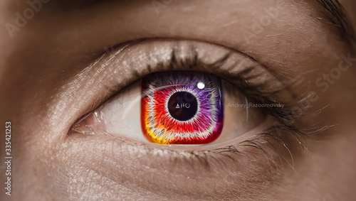 Unusual eye with an iris in the form of instagram