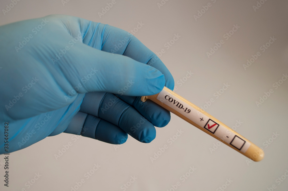 Obraz premium Test tube with coronavirus tests in the hand of a medical professional