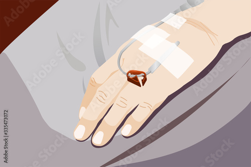 Patient's hand with drip receiving a saline solution.