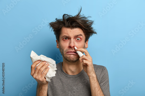 Fotografia Photo of unhappy European man with runny nose, holds nasal drops and handkerchie