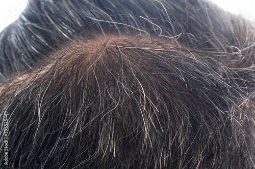  Macro gray-hair or white hoary hair on the head of old man