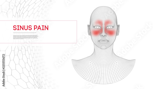 Nose sinus pain woman. Nasal infection, frontal sinus pain nose anatomy. Woman human face. Vector illustration medical concept.