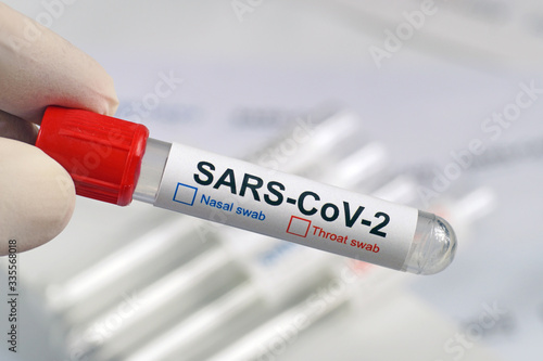 Tests for the presence of coronavirus in the body. Sampling vials for nasal or throat swab. COVID -19 (SARS CoV-2).