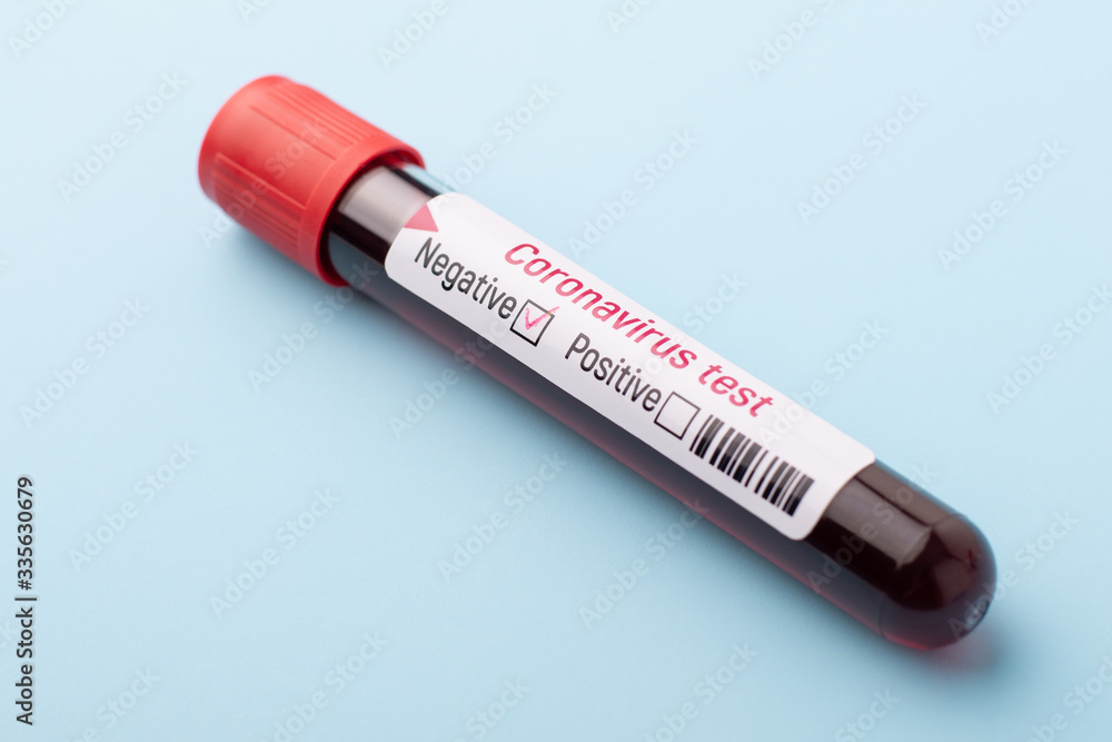 The patient has overcome coronavirus disease. Negative test on Covid-19 virus. Good news to the patient, end of the coronavirus pandemic The patient has overcome coronavirus disease. Negative test on Covid-19 virus. Good news to the patient, end of the coronavirus pandemic